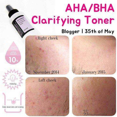 aha bha toner cosrx review