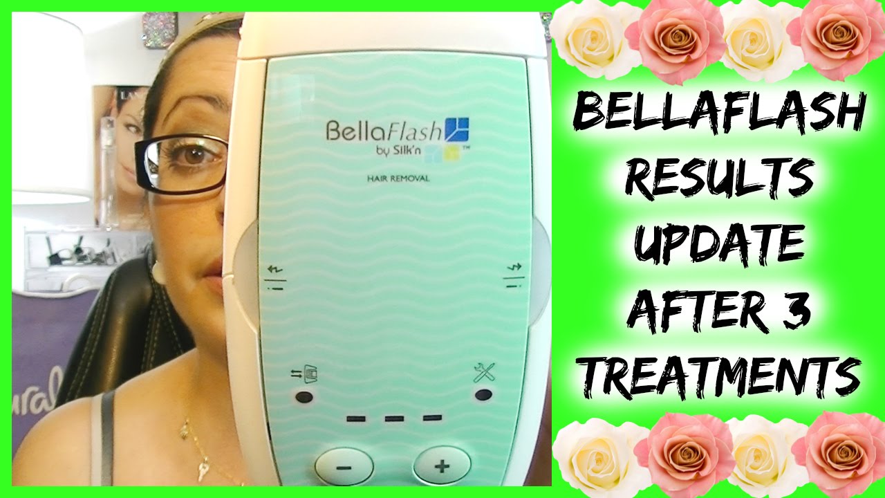 bellaflash hair removal system by silk n review